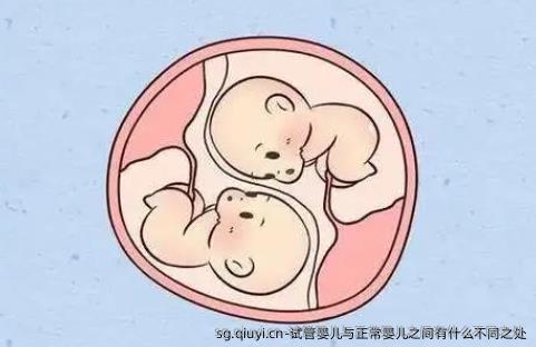试管婴儿与正常婴儿之间有什么不同之处