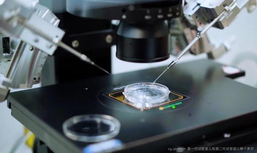 第一代试管婴儿和第二代试管婴儿哪个更好