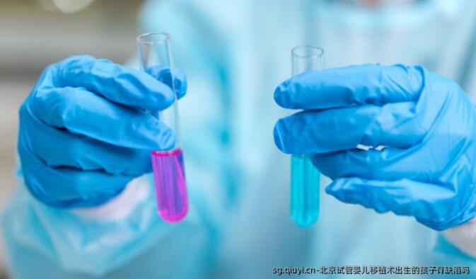 北京试管婴儿移植术出生的孩子有缺陷吗