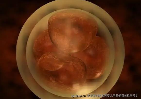 北京夫妇做试管婴儿前要做哪些检查呢？