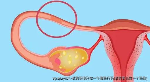 试管医院只放一个囊胚行吗(试管婴儿放一个胚胎)