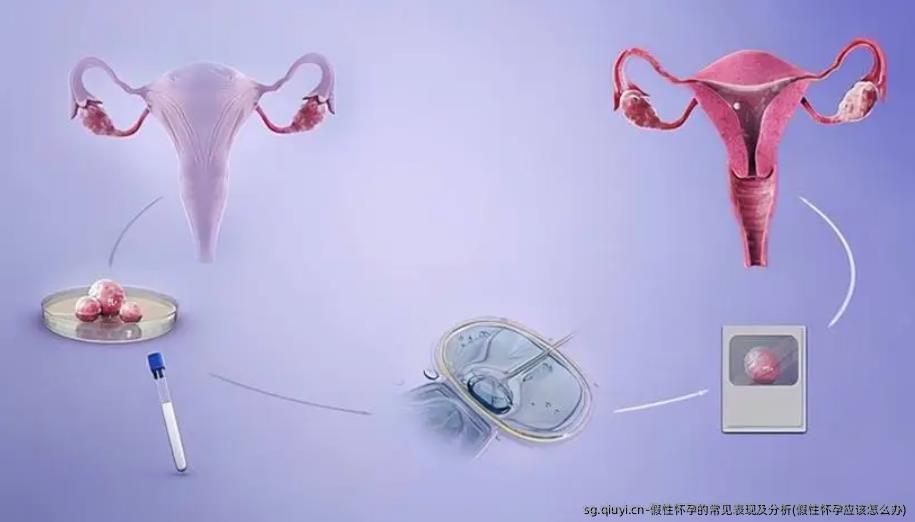 假性怀孕的常见表现及分析(假性怀孕应该怎么办)
