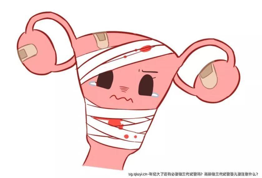 年纪大了还有必要做三代试管吗？高龄做三代试管婴儿要注意什么？