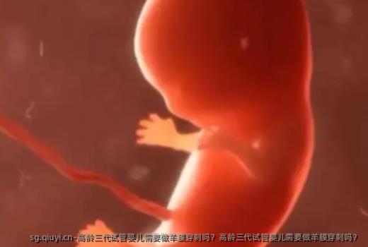 高龄三代试管婴儿需要做羊膜穿刺吗？高龄三代试管婴儿需要做羊膜穿刺吗？