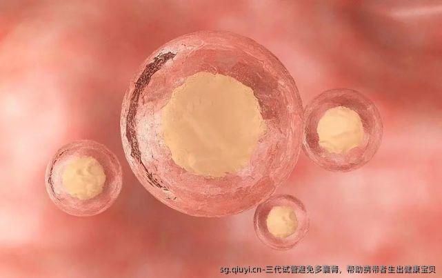 三代试管避免多囊肾，帮助携带者生出健康宝贝