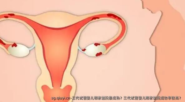 三代试管婴儿哪家医院最成熟？三代试管婴儿哪家医院成功率较高？