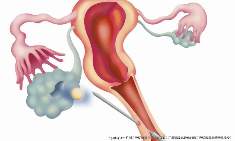 广州三代试管婴儿医院可以吗？广州哪家医院可以做三代试管婴儿费用是多少？