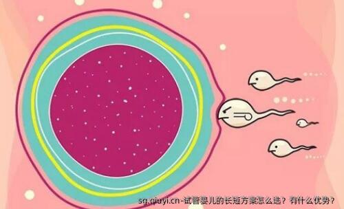 试管婴儿的长短方案怎么选？有什么优势？