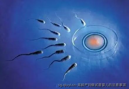高龄产妇做试管婴儿的注意事项