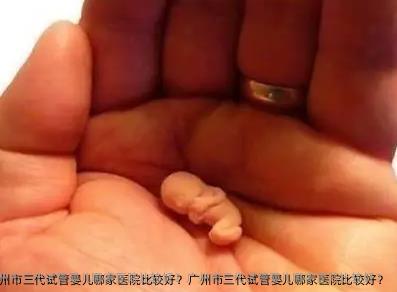 广州市三代试管婴儿哪家医院比较好？广州市三代试管婴儿哪家医院比较好？