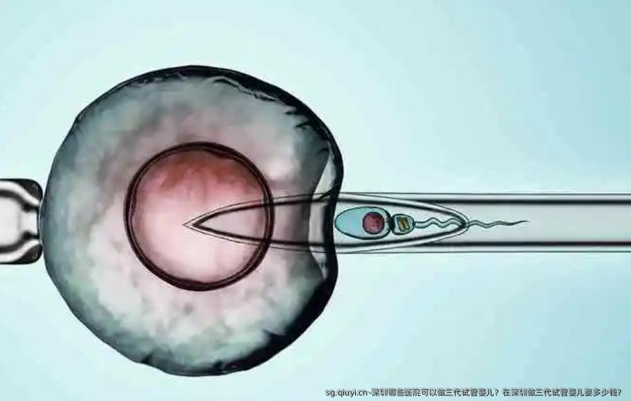 深圳哪些医院可以做三代试管婴儿？在深圳做三代试管婴儿要多少钱？