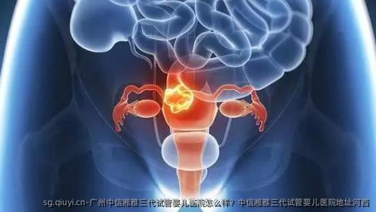 广州中信湘雅三代试管婴儿医院怎么样？中信湘雅三代试管婴儿医院地址河西