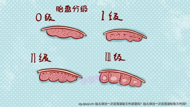 胎儿停过一次还需要做三代试管吗？胎儿停过一次还需要检查三代吗？