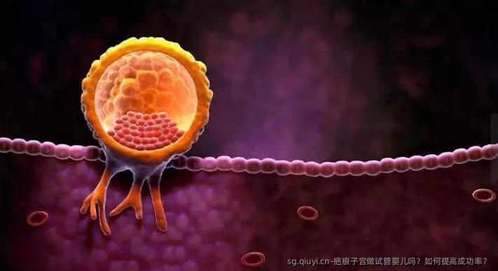 疤痕子宫做试管婴儿吗？如何提高成功率？
