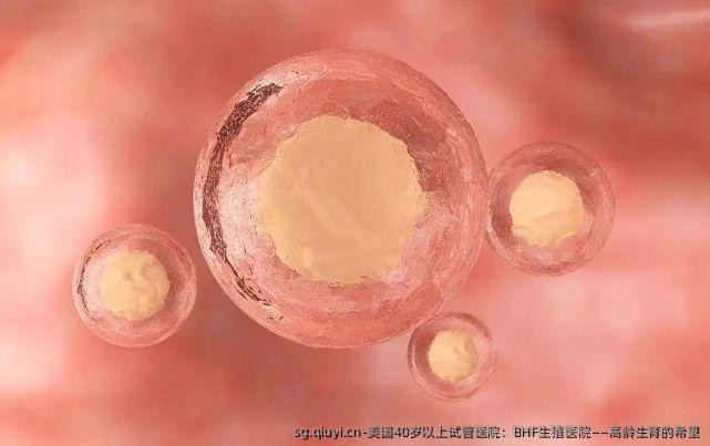美国40岁以上试管医院：BHF生殖医院——高龄生育的希望