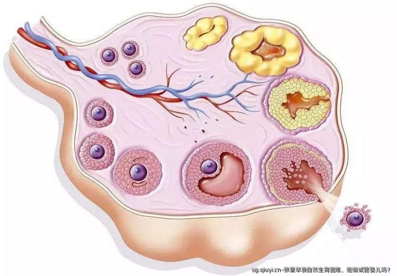 卵巢早衰自然生育困难，能做试管婴儿吗？
