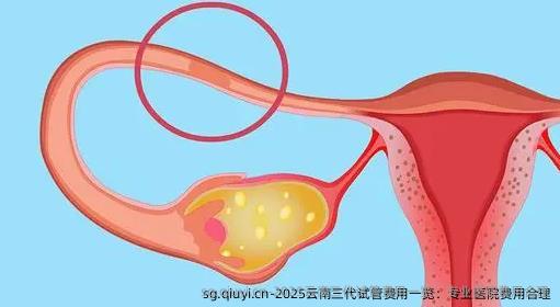 2025云南三代试管费用一览：专业医院费用合理