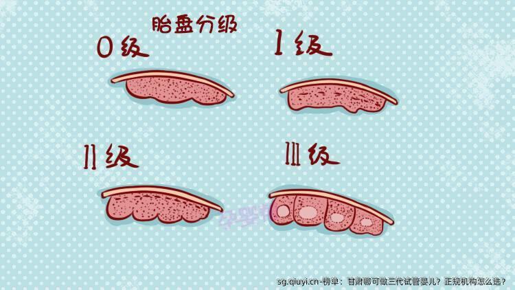 榜单：甘肃哪可做三代试管婴儿？正规机构怎么选？