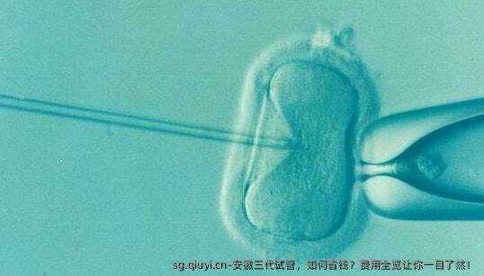 安徽三代试管，如何省钱？费用全览让你一目了然！