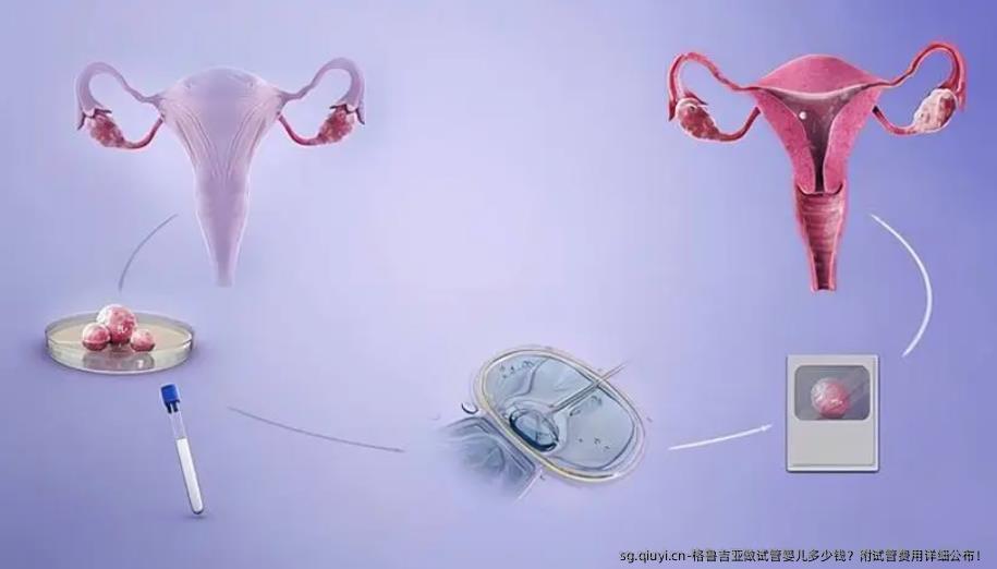 格鲁吉亚做试管婴儿多少钱？附试管费用详细公布！