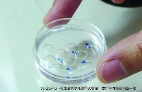 天津试管婴儿费用大揭秘，成功率与费用明细一览！