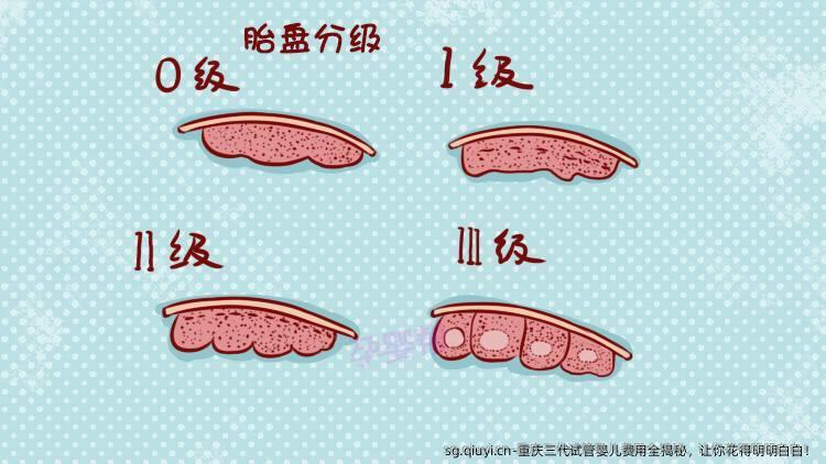 重庆三代试管婴儿费用全揭秘，让你花得明明白白！