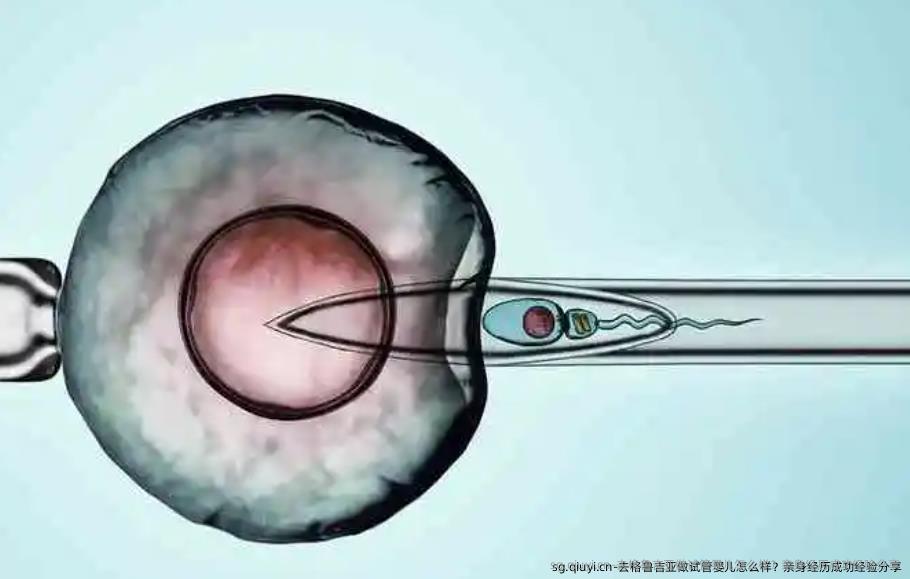 去格鲁吉亚做试管婴儿怎么样？亲身经历成功经验分享