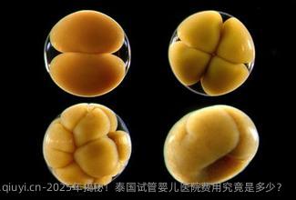 2025年揭秘！泰国试管婴儿医院费用究竟是多少？