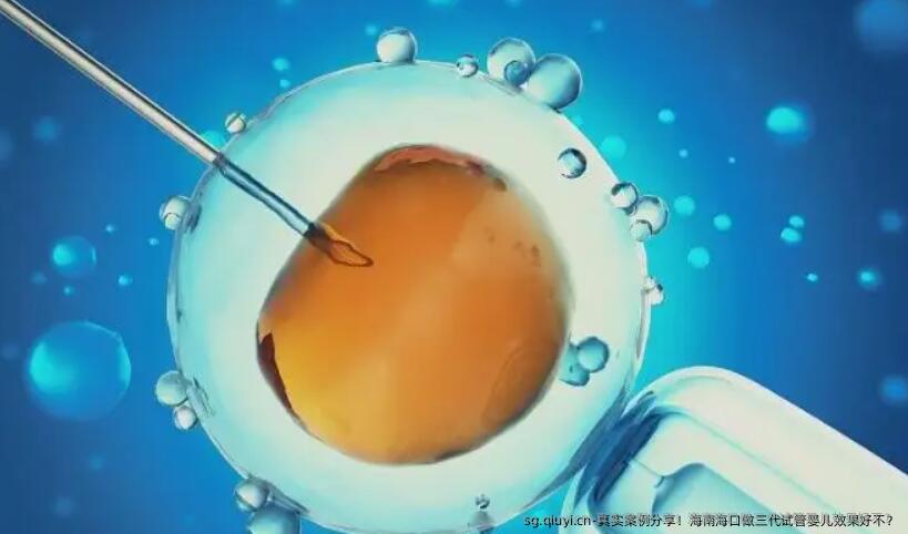 真实案例分享！海南海口做三代试管婴儿效果好不？
