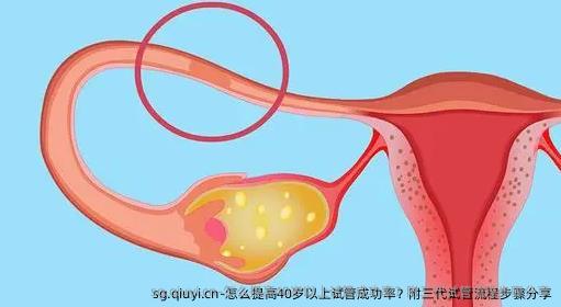怎么提高40岁以上试管成功率？附三代试管流程步骤分享