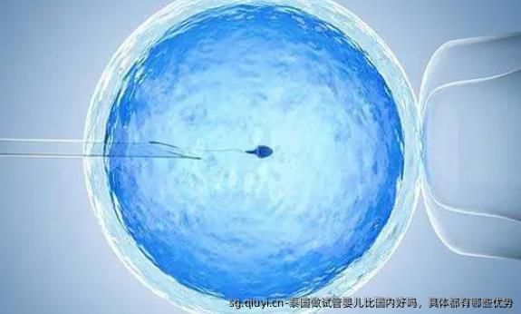 泰国做试管婴儿比国内好吗，具体都有哪些优势