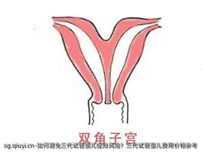 如何避免三代试管婴儿促排风险？三代试管婴儿费用价格参考
