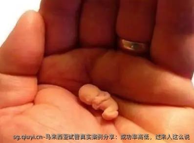 马来西亚试管真实案例分享：成功率高低，过来人这么说
