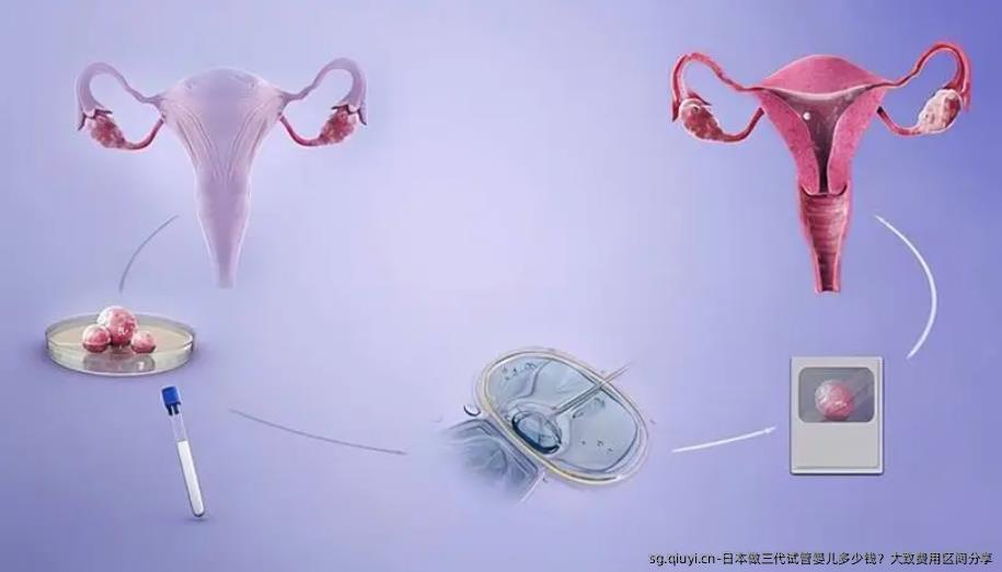 日本做三代试管婴儿多少钱？大致费用区间分享