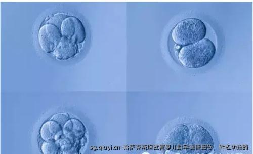 哈萨克斯坦试管婴儿助孕流程细节，附成功攻略