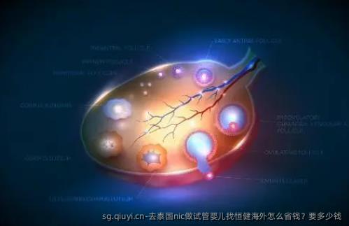 去泰国nic做试管婴儿找**海外怎么省钱？要多少钱