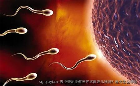 去亚美尼亚做三代试管婴儿好吗？技术怎么样呢