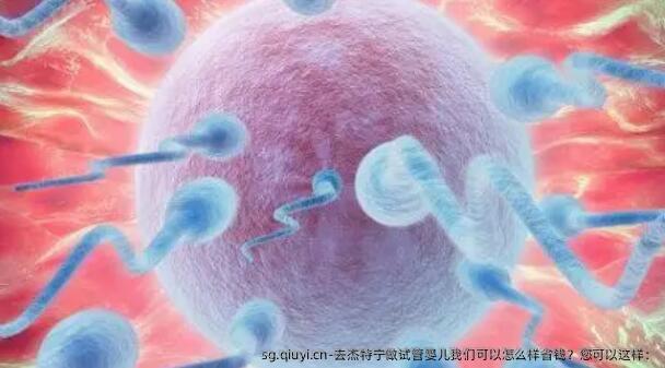 去杰特宁做试管婴儿我们可以怎么样省钱？您可以这样：