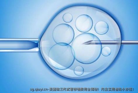 美国做三代试管移植费用全揭秘！内含实用省钱小妙招！