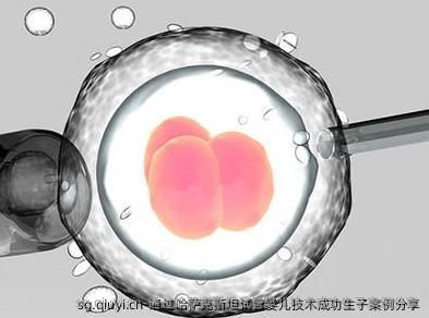 通过哈萨克斯坦试管婴儿技术成功生子案例分享