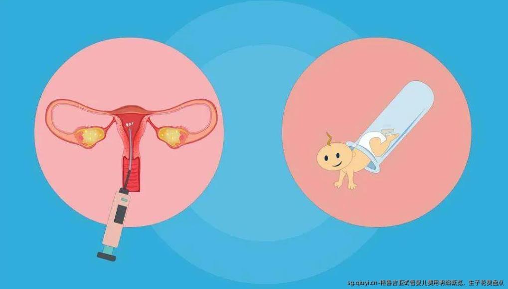 格鲁吉亚试管婴儿费用明细概览，生子花费盘点