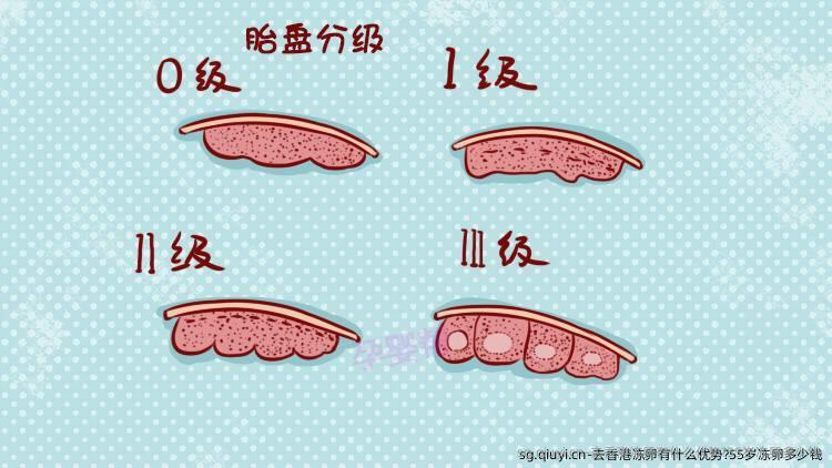 去香港雪藏卵有什么优势?55岁雪藏卵多少钱