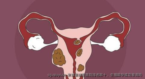 柬埔寨试管医院排名前十，生殖助孕成功率高吗