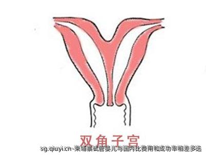 柬埔寨试管婴儿与国内比费用和成功率相差多远