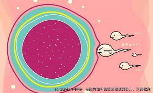 探秘：从国内如何去美国做试管婴儿，攻略收藏