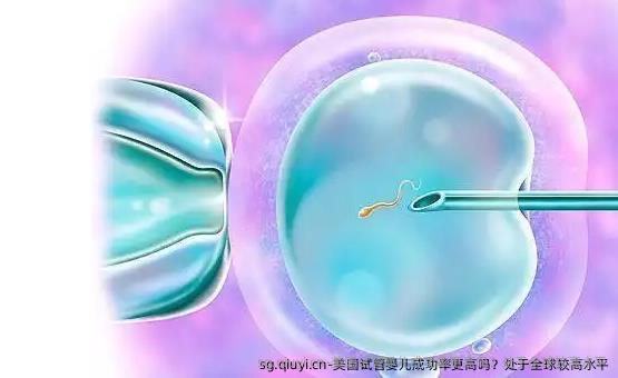 美国试管婴儿成功率更高吗？处于全球较高水平