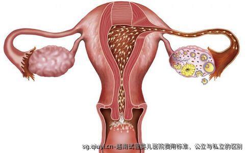 越南试管婴儿医院费用标准，公立与私立的区别