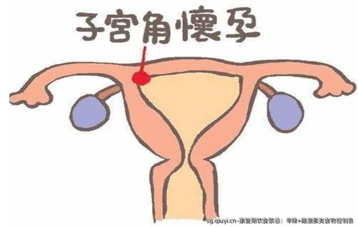 康复期饮食禁忌：辛辣+雌激素类食物控制表