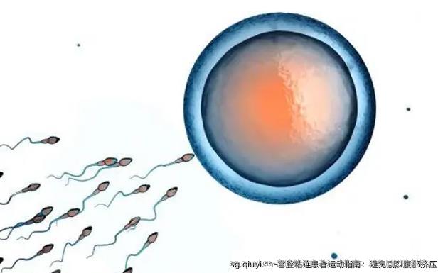 宫腔粘连患者运动指南：避免剧烈腹部挤压