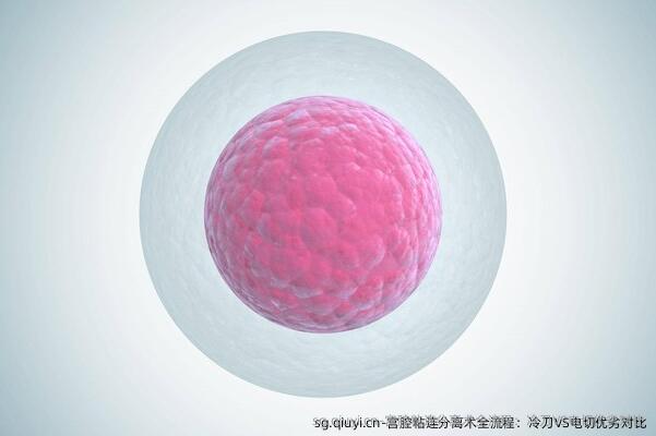 宫腔粘连分离术全流程：冷刀VS电切优劣对比